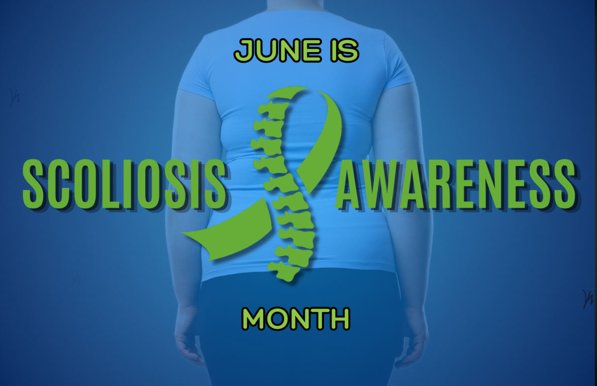 Discover How This Highlander Deals With Scoliosis on a Day‑to‑Day Basis | Thumbnail edited on Canva.