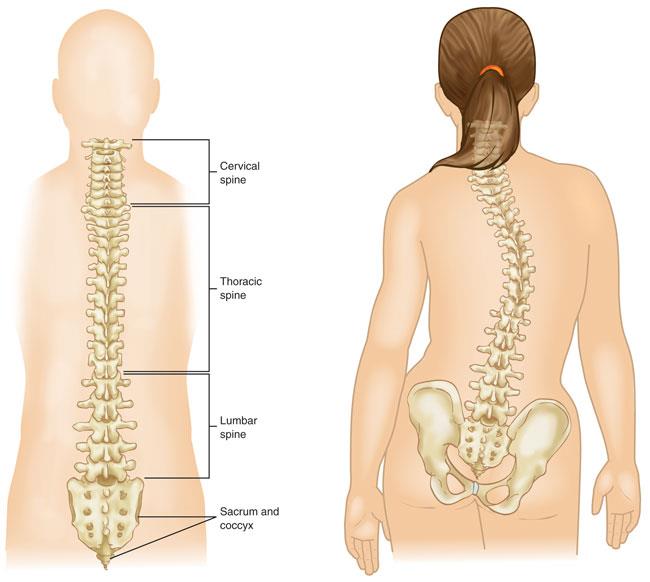 National Scoliosis Awareness Month, Exclusive Interview With A Highlander!